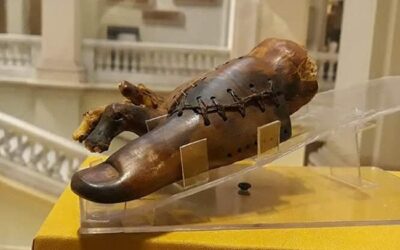 تاريخ الأطراف الاصطناعية: من الخشب والمعدن إلى الذكاء الاصطناعي