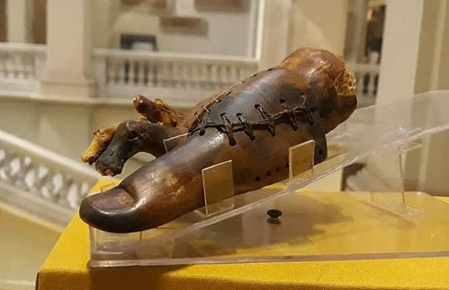 تاريخ الأطراف الاصطناعية: من الخشب والمعدن إلى الذكاء الاصطناعي